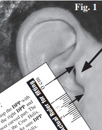 Tragus Measurement